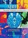 Mri Normal Variants And Pitfalls