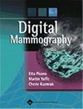 Digital Mammography