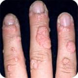 Get <a href=