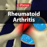 Rheumatoid Arthritis