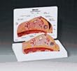Breast Cross Section Model
