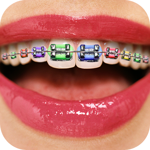 Teeth Braces Booth
