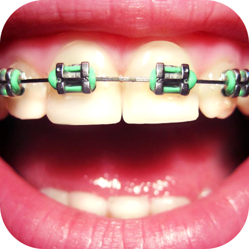 Dental Brace Booth