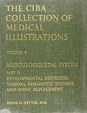 Netter, Frank Henry: Musculoskeletal System, Part 2: Developmental Disorders, Tumors, Rheumatic Diseases, and Joint Replacement Netter, Frank Henry: Musculoskeletal System, Part 2: Developmental Disorders, Tumors, Rheumatic Diseases, and Joint Replacement