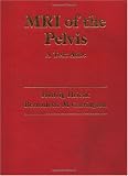 Hricak, Hedvig: Mri of the Pelvis: A Text Atlas Hricak, Hedvig: Mri of the Pelvis: A Text Atlas