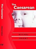[???]: The Caesarean