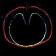 Wasp Star (Apple Venus, Pt. 2)