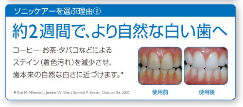 PHILIPS sonicare 電動歯ブラシ Flex Care+ HX6921/02