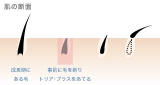 �g���A�E�p�[�\�i�����[�U�[�E�ъ킪�I�΂�闝�R_���ւ̕��S�͍ŏ���
