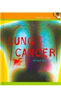 Lung Cancer (Health Alert) by Marlene Targ Brill