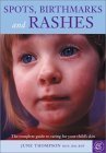 Spots, Birthmarks and Rashes: The Complete Guide to Caring for Your Child's Skin by June Thompson RGN RM RHV