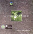 Algopix Similar Product 16 - Laparoscopic Bowel Resection Featuring