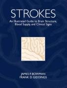 Strokes: An Illustrated Guide to Brain Structure, Blood Supply and Clinical Signs by James P. Bowman Ph.D.
