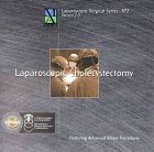 Algopix Similar Product 3 - Laparoscopic Cholecystectomy Featuring
