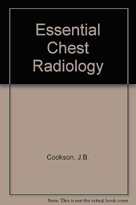 Essential Chest Radiology