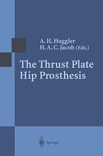 Algopix Similar Product 7 - The Thrust Plate Hip Prosthesis