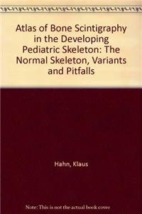 Atlas of Bone Scintigraphy in the Developing Pediatric Skeleton: The Normal Skeleton, Variants and Pitfalls