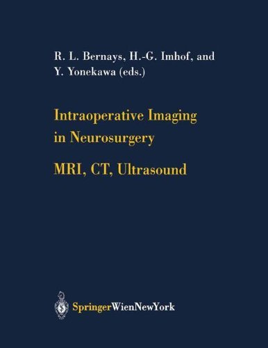 Intraoperative Imaging in Neurosurgery: MRI, CT, Ultrasound (Acta Neurochirurgica Supplement Book 85) by R.L. Bernays
