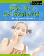 Why Do I Get Sunburn?: And Other Questions About Skin (Body Matters) by Angela Royston