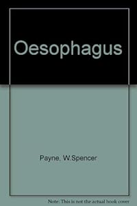 Esophagus by Spencer Payne