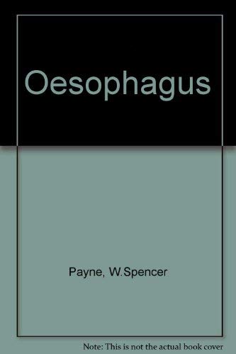 Esophagus by Spencer Payne