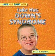 Luke Has Downs Syndrome