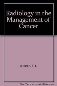 Radiology in the Management of Cancer by R. J. Johnson
