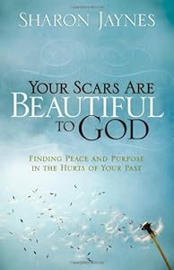 Your Scars Are Beautiful to God: Finding Peace and Purpose in the Hurts of Your Past