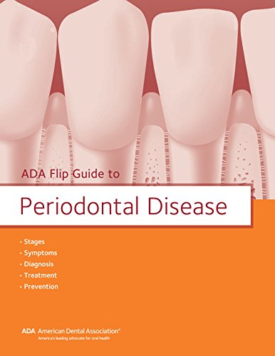 Algopix Similar Product 14 - ADA Flip Guide to Periodontal Disease
