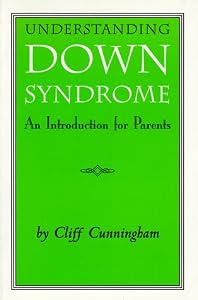 Understanding Down syndrome