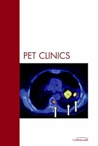 Lung Cancer, An Issue of PET Clinics (Volume 1-4) (The Clinics: Radiology, Volume 1-4) by Fletcher