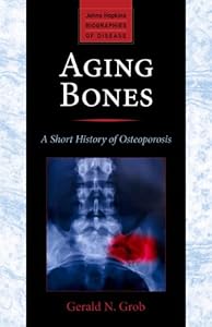 Aging Bones