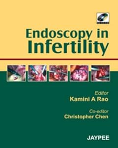 Endoscopy in Infertility by Kamini A. Rao