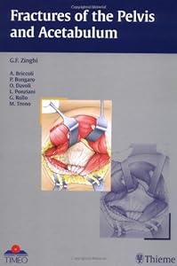 Fractures of the Pelvis and Acetabulum by Gianfranco Zinghi