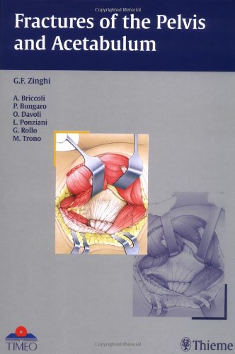 Fractures of the Pelvis and Acetabulum by Gianfranco Zinghi