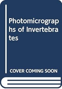 Photomicrographs of Invertebrates by Arthur Charles Shaw