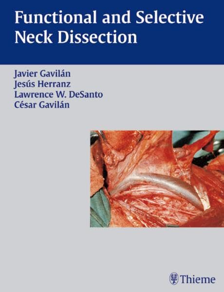 Functional and Selective Neck Dissection by Javier Gavilan