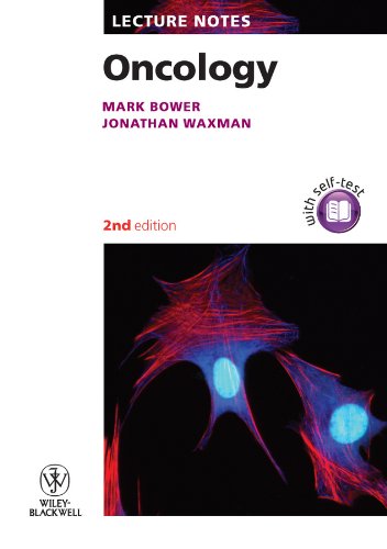 Oncology (Lecture Notes Book 61) by Mark Bower