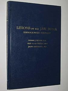 Lesions of the Jaw Bone: Radiographic Features by Vivian J. Harris