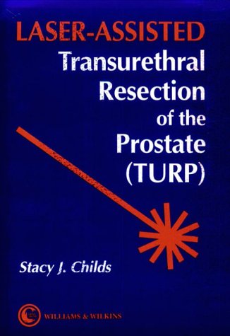 Algopix Similar Product 4 - LaserAssisted Transurethral Resection