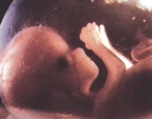 Ein Leben entsteht - Zeugung, Entwicklung, Geburt - DVD - Lehrfilm für Unterricht und Ausbildung - Hagemann 180234 - Einzellizenz - 