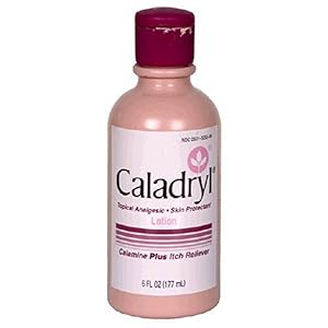 Caladryl Lotion, Calamine Plus Itch Reliever, 6-Ounce Bottle
