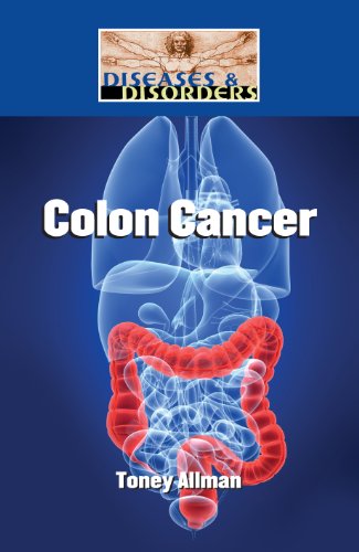 Colon Cancer by Toney Allman