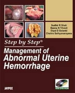 Management of Abnormal Uterine Hemorrhage (Step by Step) by R. Sudhir Shah