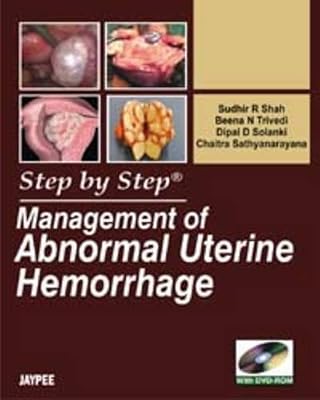 Management of Abnormal Uterine Hemorrhage (Step by Step)