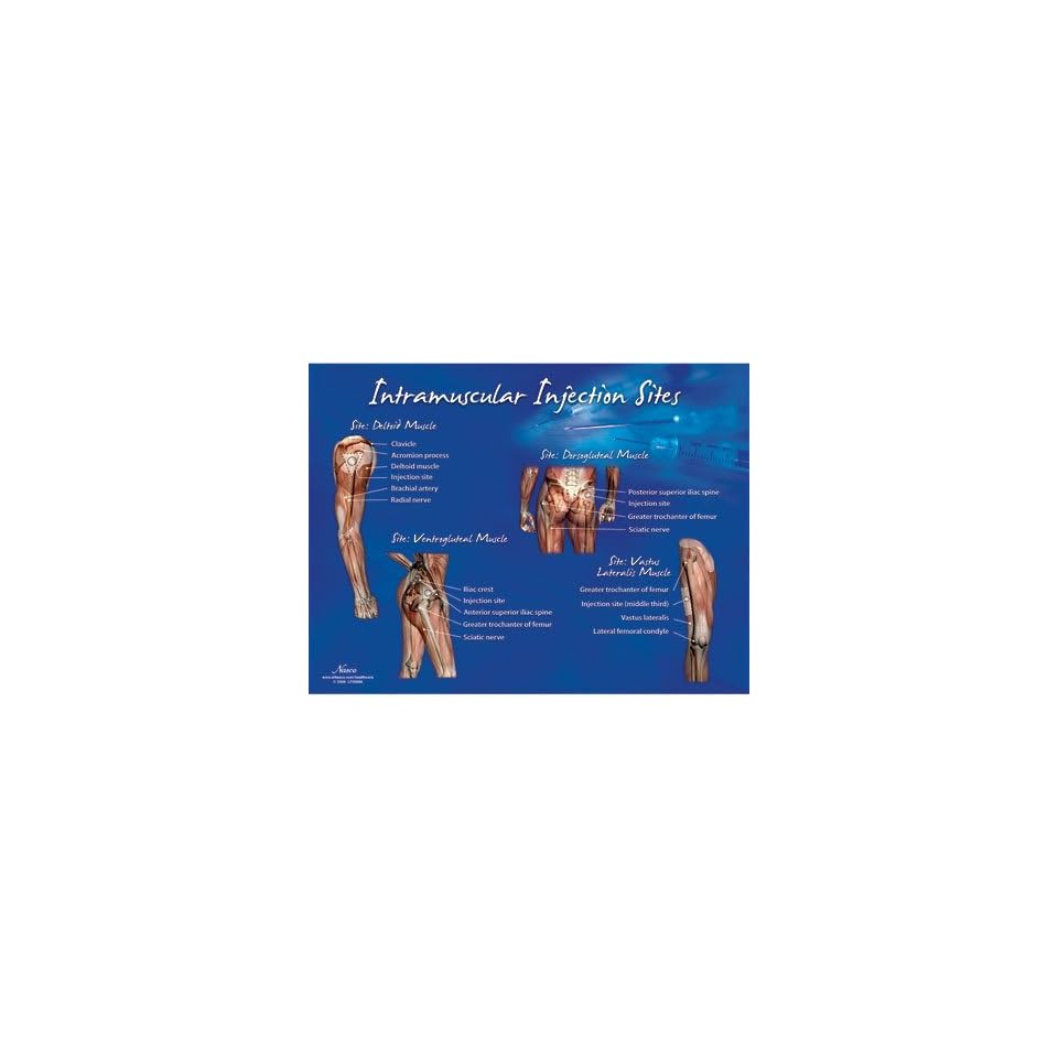 Intramuscular Injection Sites Chart