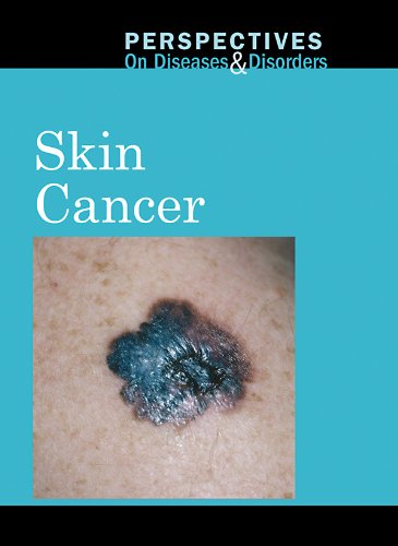 Skin Cancer (Perspectives on Diseases and Disorders) by Carrie Fredericks