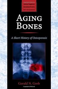 Aging Bones: A Short History of Osteoporosis