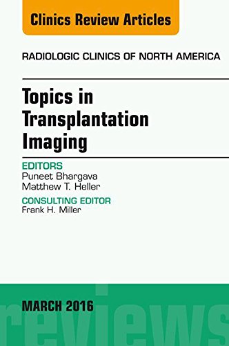 Topics in Transplantation Imaging, An Issue of Radiologic Clinics of North America (The Clinics: Radiology Book 54) by Puneet Bhargava