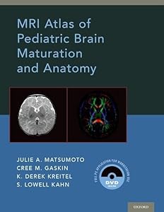 MRI Atlas of Pediatric Brain Maturation and Anatomy by Julie A. Matsumoto